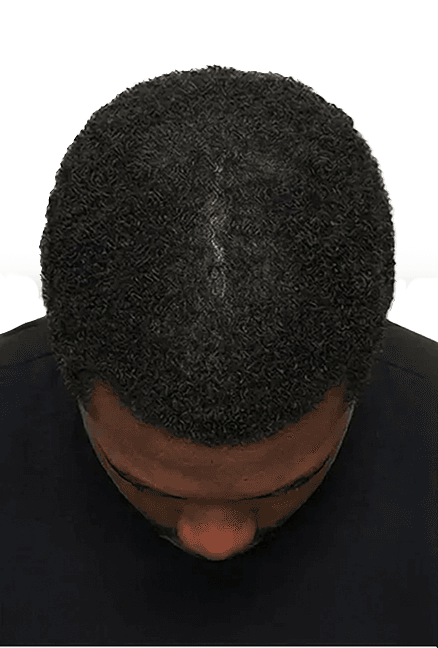 Month 6
