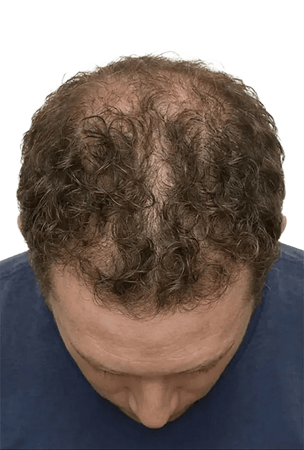 Month 6