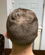 Month 7