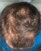 Month 9
