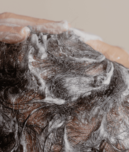 Buy Prescription Ketoconazole Shampoo for Dandruff Keeps