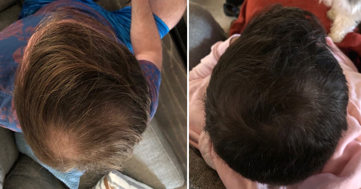 Jose Before & After