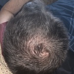 Christopher - before