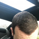 Evan - before
