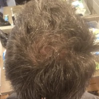James C. - before