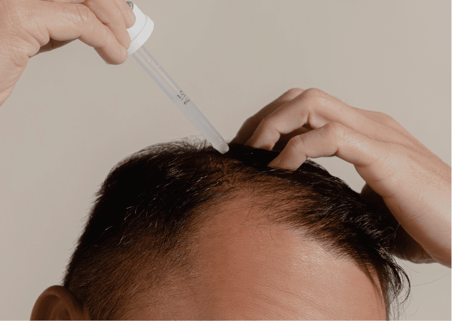 Do Hair Growth Products Actually work? | SpaMedica