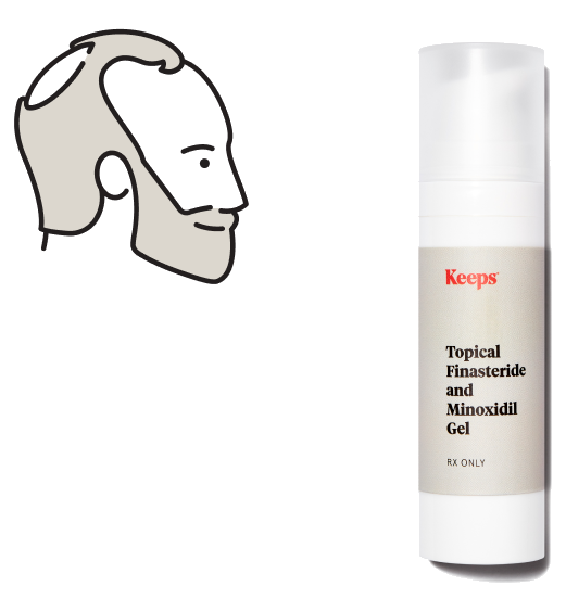 Overall Thinning Hair